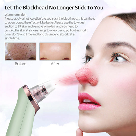 Electric Pore Vacuum & Blackhead Remover
